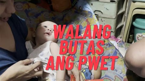 butas ng pwet|Sakit sa puwit (sakit ng puwit) .